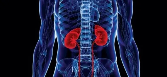 chronic kidney disease